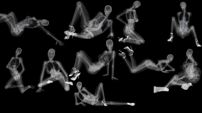 Обои картинки фото разное, кости,  рентген, скелеты, девушки, позы, каблуки