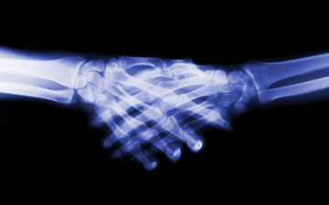 Картинка разное кости +рентген руки рукопожатие