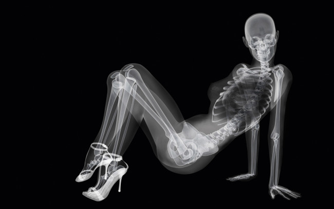 Обои картинки фото разное, кости, рентген, скелет, девушка