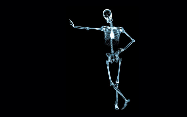 Обои картинки фото разное, кости,  рентген, скелет, человек
