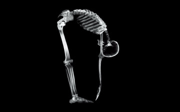 обоя разное, кости,  рентген, скелет, человек, наклон