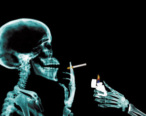 Картинка разное кости рентген