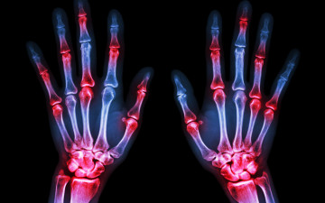 Картинка разное кости +рентген рентген фон руки