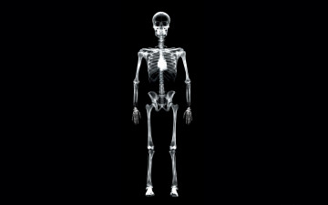 Картинка разное кости +рентген скелет