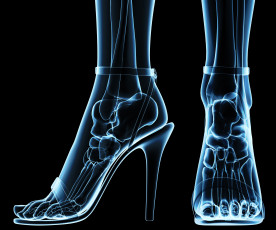Картинка разное кости +рентген каблуки