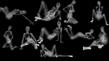 Картинка разное кости +рентген скелеты девушки позы каблуки