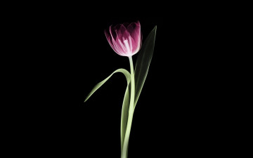 Картинка разное кости +рентген цветок тюльпан