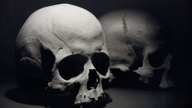 Обои картинки фото разное, кости, рентген, череп, черно-белое, тьма, скелет