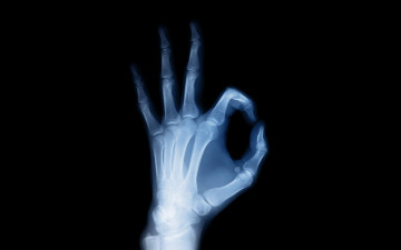 Картинка разное кости +рентген фон пальцы