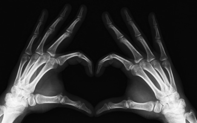 Обои картинки фото разное, кости,  рентген, руки, сердечко