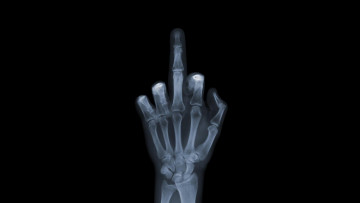 Картинка разное кости рентген рука fuck you фак ю снимок