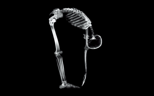 Обои картинки фото разное, кости,  рентген, скелет, человек, наклон