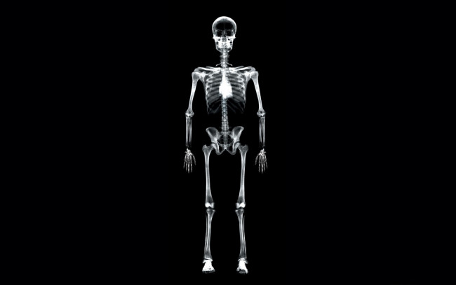 Обои картинки фото разное, кости,  рентген, скелет